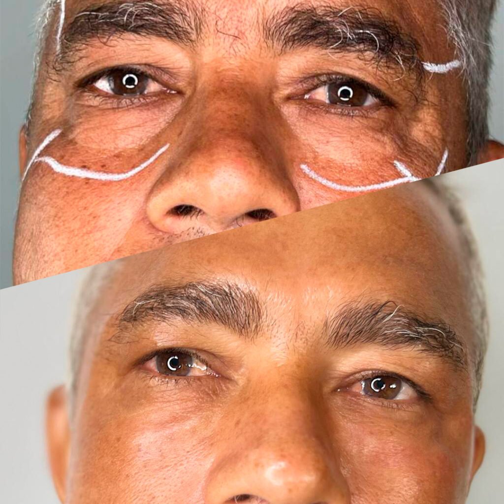 hh